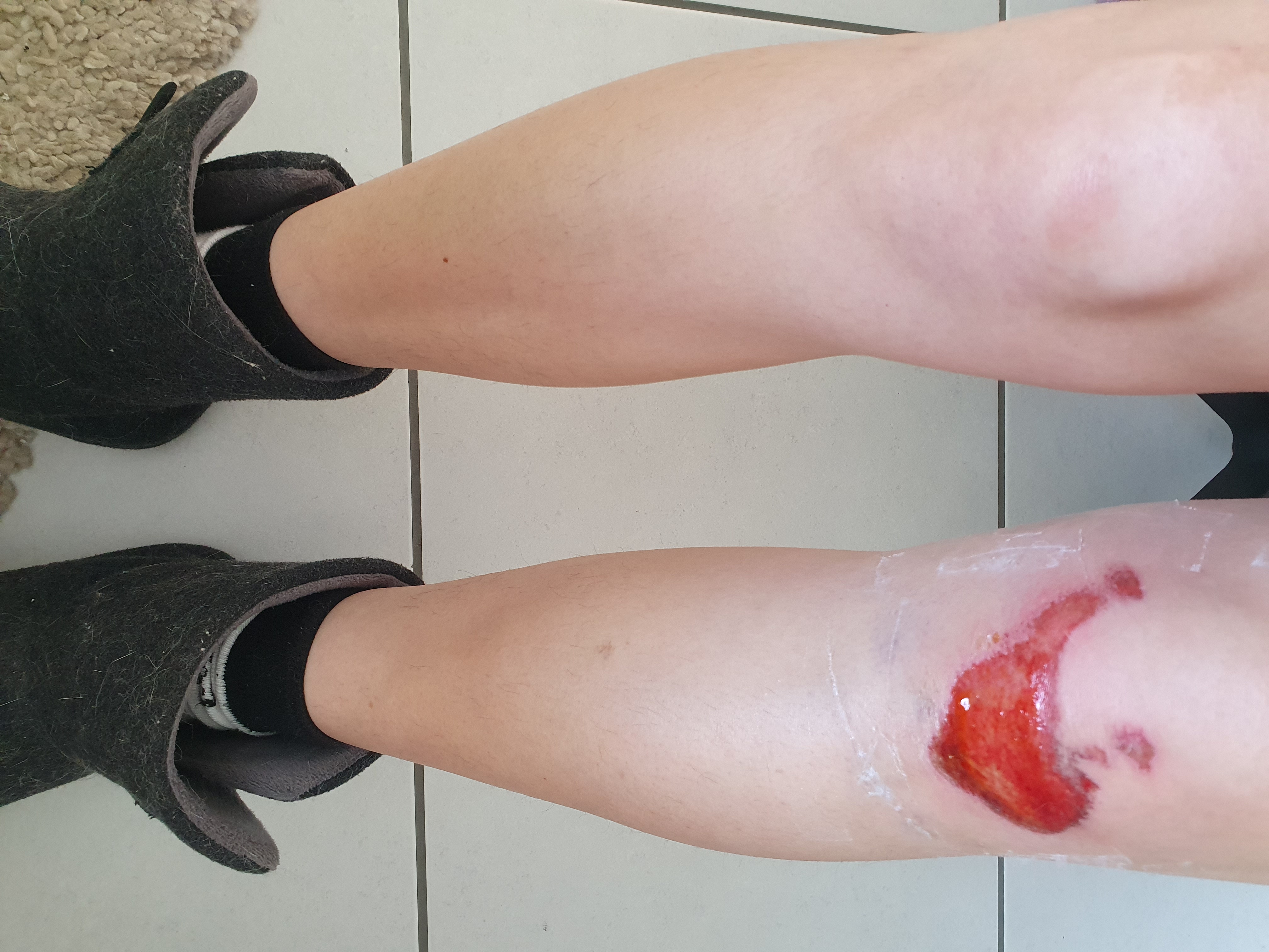 scab